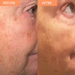 Load image into Gallery viewer, Skinician Vitamin C Elixir 15ml
