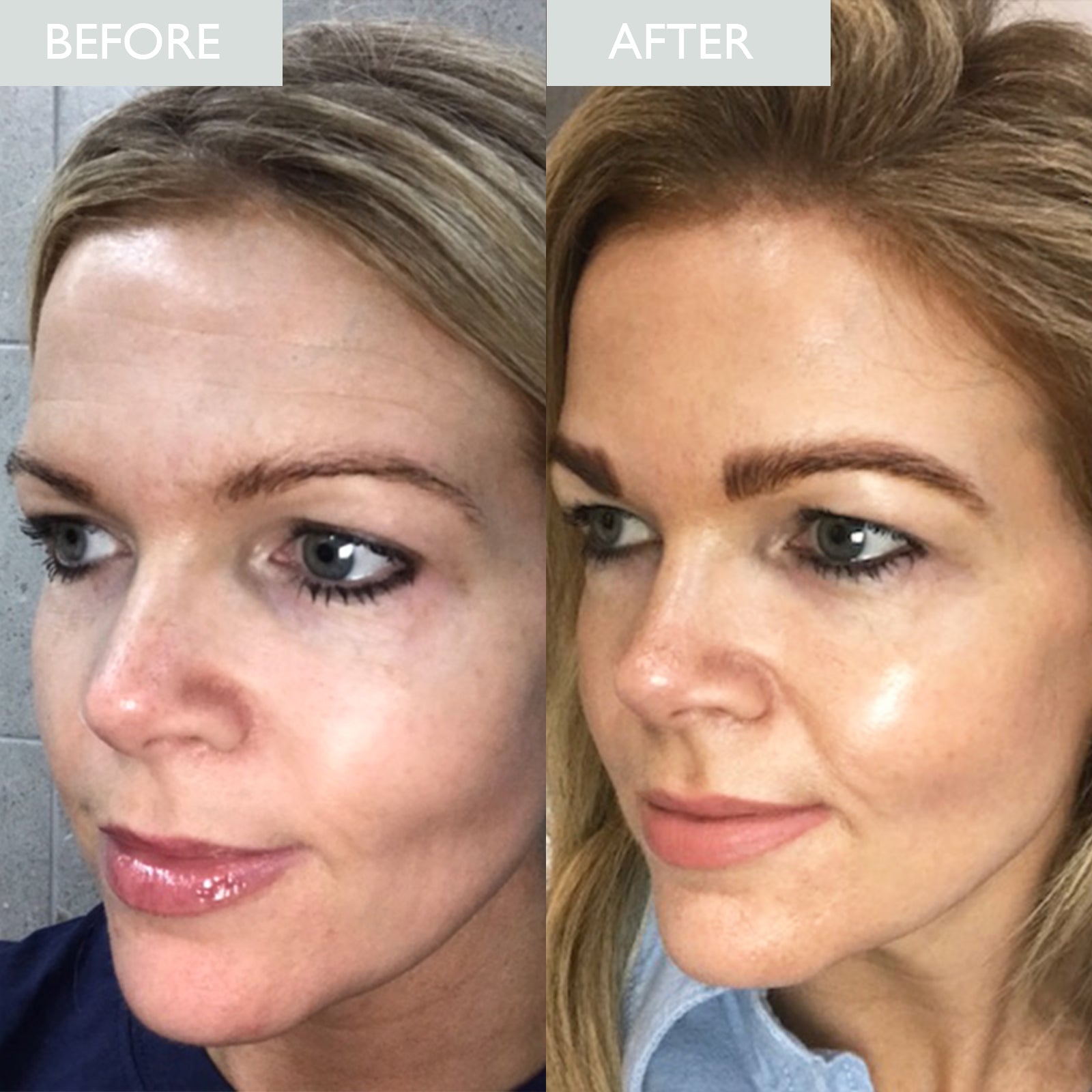 Skinician Lift & Glow Set