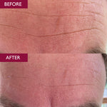 Load image into Gallery viewer, Skinician Lift &amp; Glow Set
