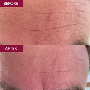 Skinician Lift & Glow Set