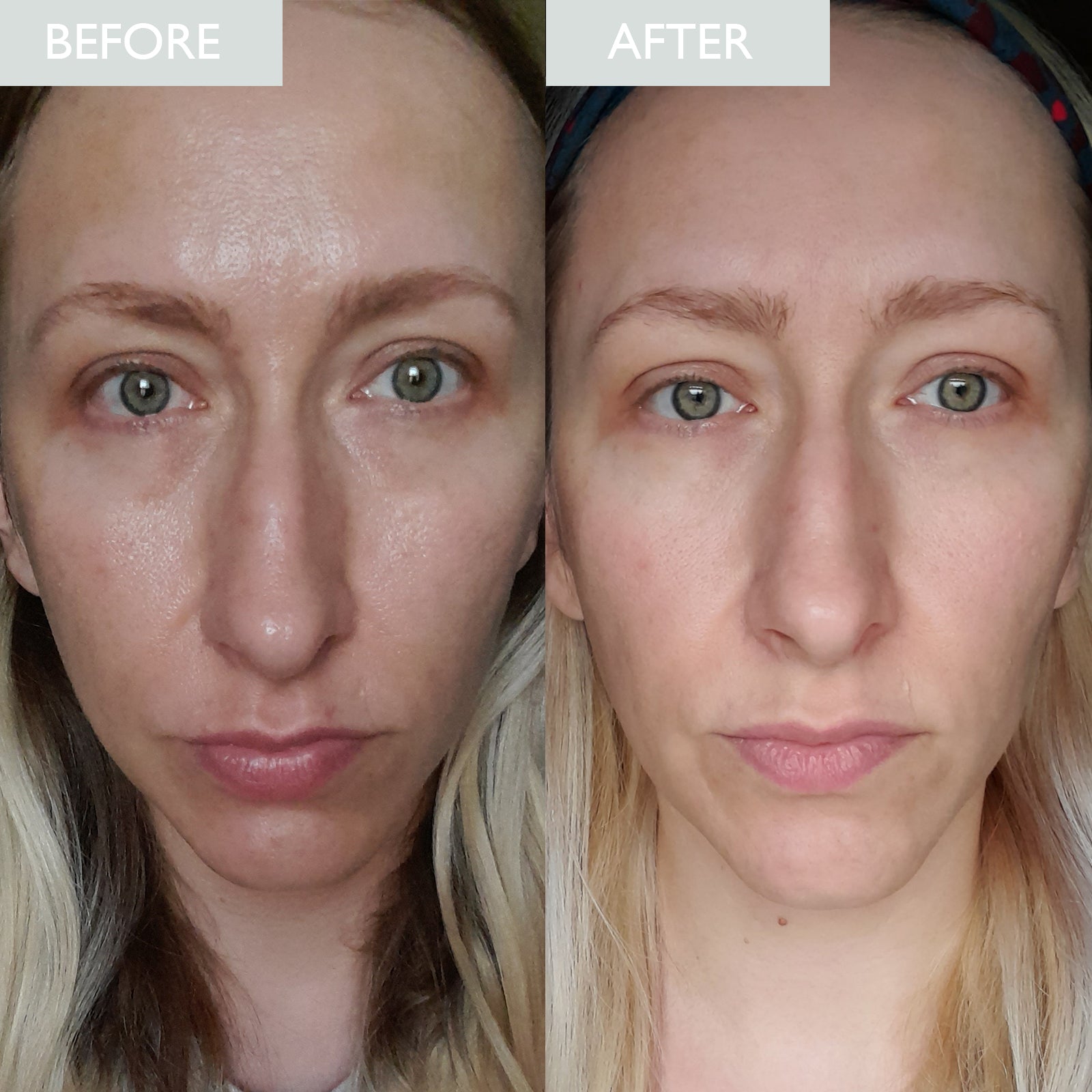 Skinician Mattify & Refresh Set