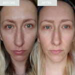 Load image into Gallery viewer, Skinician Mattify &amp; Refresh Set
