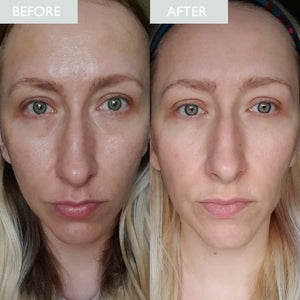 Skinician Mattify & Refresh Set