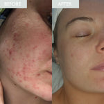 Load image into Gallery viewer, Skinician Mattify &amp; Refresh Set

