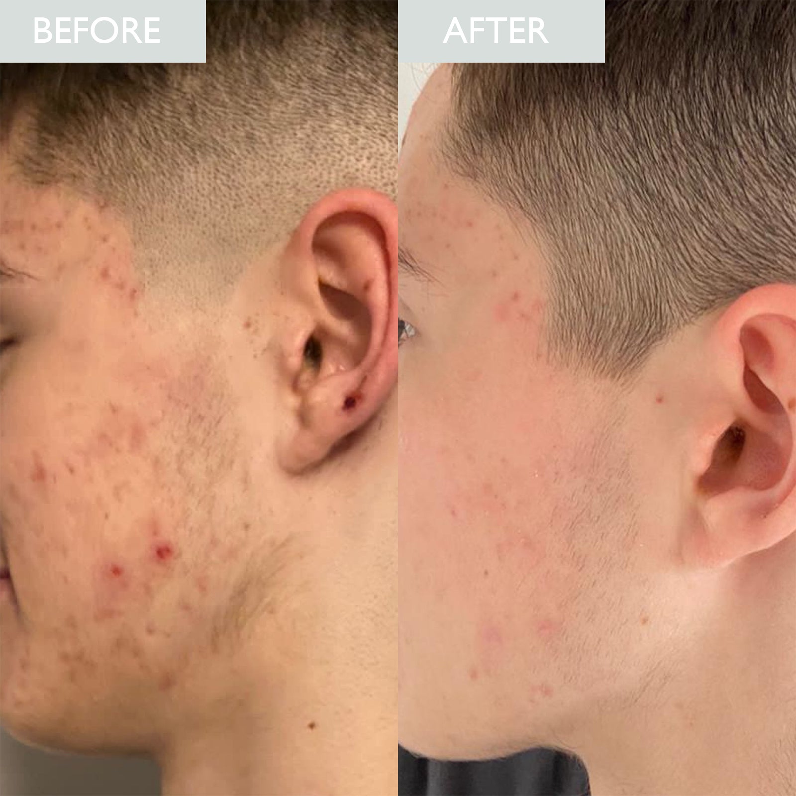 Skinician Mattify & Refresh Set