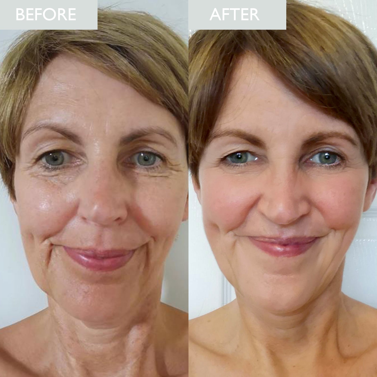Retinol, Repair & Renew Set