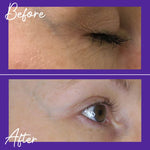 Load image into Gallery viewer, Skinician Ageless Overnight Retinol Powerbalm 50ml
