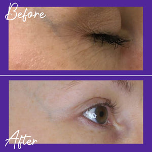 Skinician Ageless Overnight Retinol Powerbalm 50ml