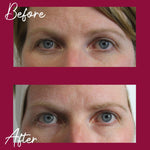 Load image into Gallery viewer, Skinician Advanced Eye Repair 15ml
